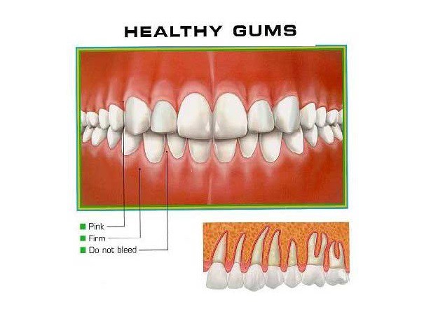 Coconut oil makes gums stronger